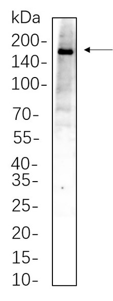 Recombinant TBC1D4 Monoclonal Antibody (AGEL5663)