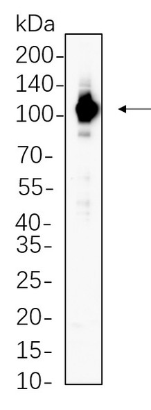 Recombinant STAT6 Monoclonal Antibody (AGEL5671)