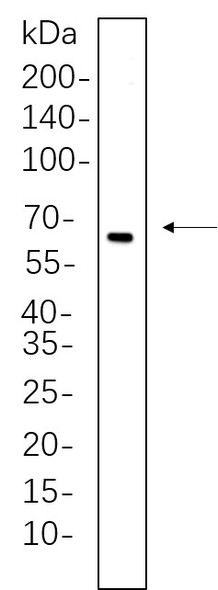 Recombinant Estrogen Receptor α Monoclonal Antibody (AGEL5677)