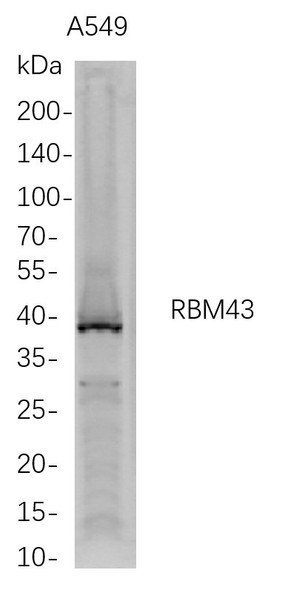 Recombinant RBM43 Monoclonal Antibody (AGEL5693)