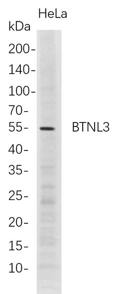 Recombinant BTNL3 Monoclonal Antibody (AGEL5701)