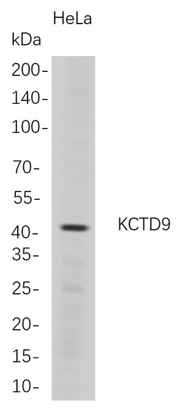 Recombinant KCTD9 Monoclonal Antibody (AGEL5702)