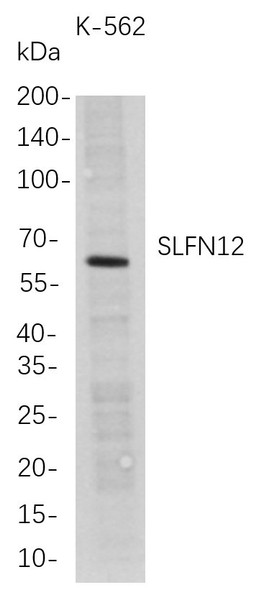 Recombinant SLFN12 Monoclonal Antibody (AGEL5713)