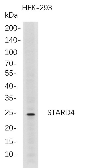 Recombinant STARD4 Monoclonal Antibody (AGEL5724)