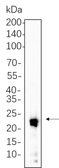Recombinant IL-10 Monoclonal Antibody (AGEL5741)