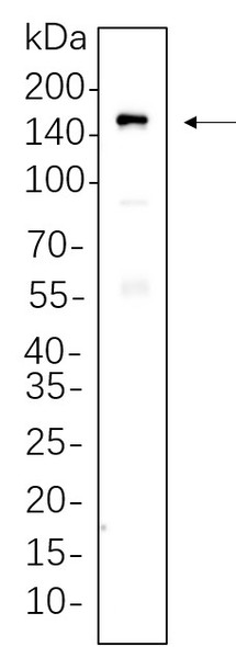 Recombinant MDR1 Monoclonal Antibody (AGEL5760)