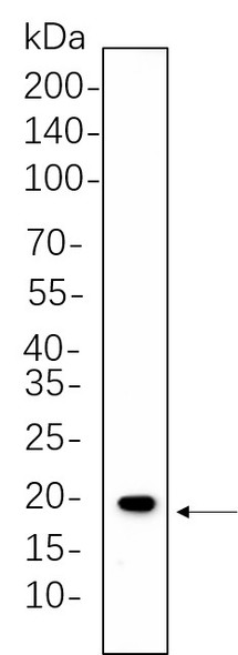 Recombinant Caveolin-1 Monoclonal Antibody (AGEL5761)