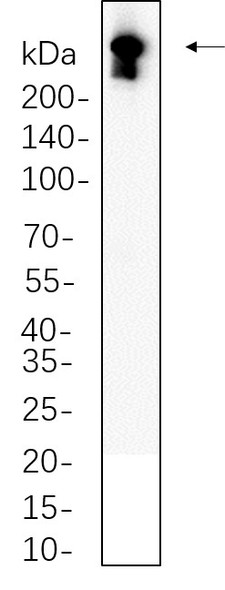 Recombinant DNA PKcs Monoclonal Antibody (AGEL5763)