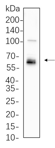 Recombinant LKB1 Monoclonal Antibody (AGEL5764)