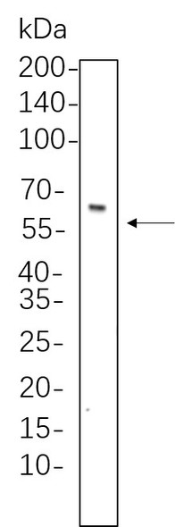 Recombinant Smad4 Monoclonal Antibody (AGEL5768)