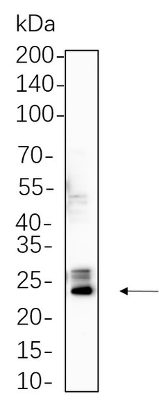Recombinant Bak Monoclonal Antibody (AGEL5769)