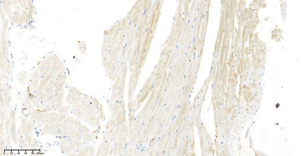 Recombinant VEGFA Monoclonal Antibody (AGEL5784)
