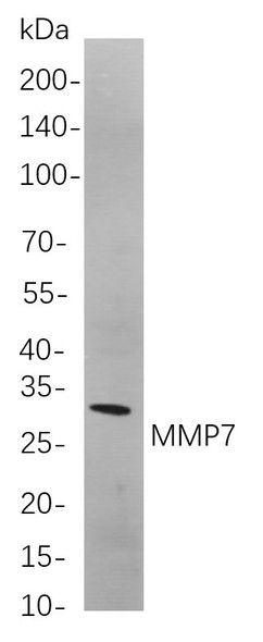 Recombinant MMP7 Monoclonal Antibody (AGEL5786)