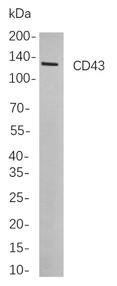 Recombinant CD43 Monoclonal Antibody (AGEL5788)