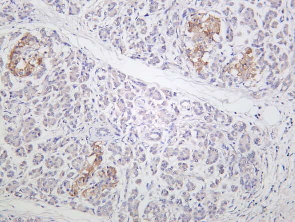 Recombinant STAT3 Monoclonal Antibody (AGEL5791)