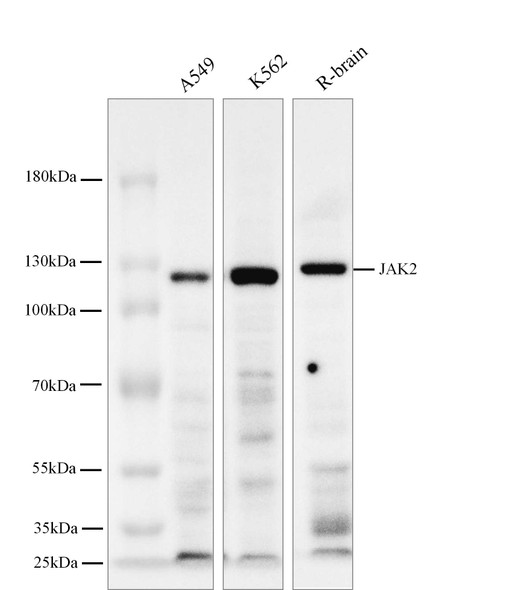 Recombinant JAK2 Monoclonal Antibody (AGEL5794)