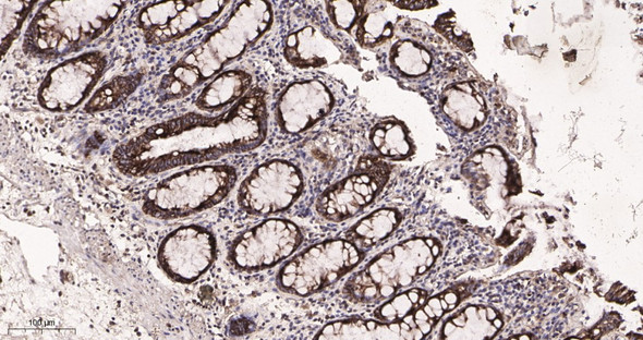 Recombinant ATG5 Monoclonal Antibody (AGEL5803)