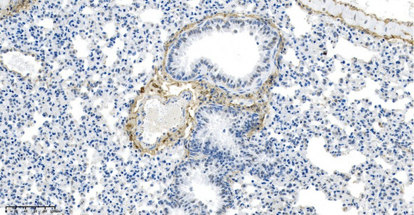 Recombinant VWF Monoclonal Antibody (AGEL5808)