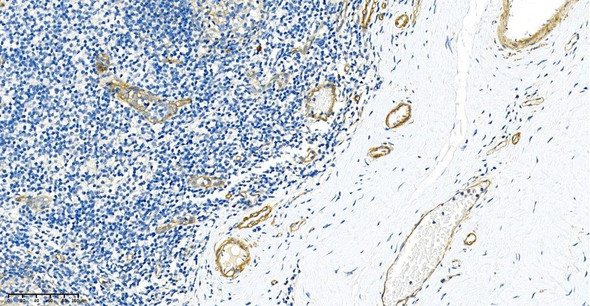 Recombinant CD146 Monoclonal Antibody (AGEL5813)