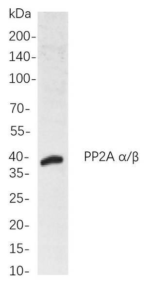 Recombinant PP2A α/β Monoclonal Antibody (AGEL5814)