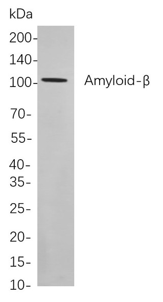 Recombinant Amyloid-β Monoclonal Antibody (AGEL5824)