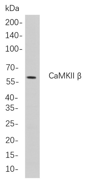 Recombinant CaMKII β Monoclonal Antibody (AGEL5826)