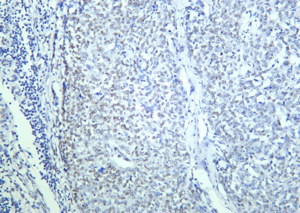 Recombinant BRG1 Monoclonal Antibody (AGEL5828)