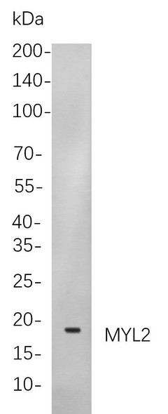 Recombinant Myosin Light Chain 2 Monoclonal Antibody (AGEL5832)