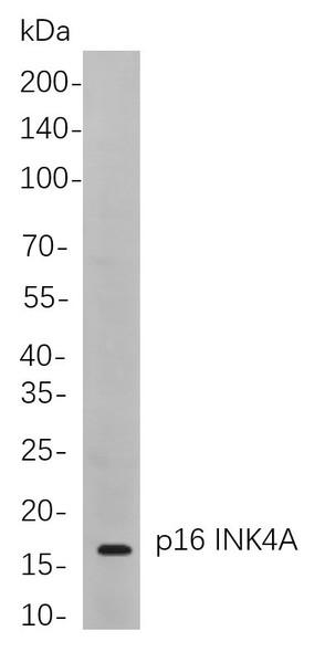 Recombinant p16 INK4A Monoclonal Antibody (AGEL5839)