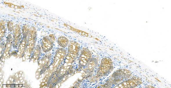 Recombinant β Catenin Monoclonal Antibody (AGEL5841)