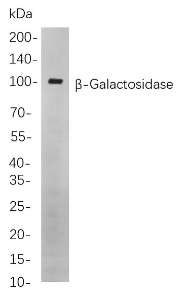 Recombinant β-Galactosidase Monoclonal Antibody (AGEL5843)