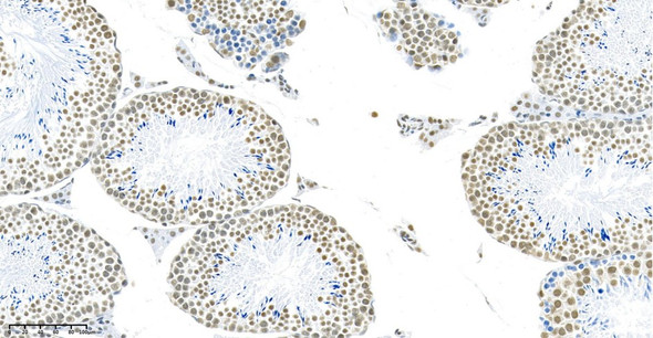 Recombinant DDX5 Monoclonal Antibody (AGEL5847)