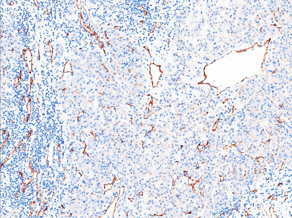 Recombinant CD31 Monoclonal Antibody (AGEL5849)