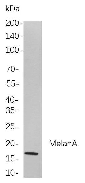 Recombinant MelanA Monoclonal Antibody (AGEL5854)