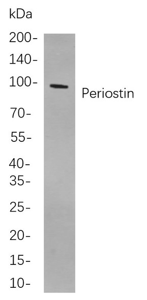 Recombinant Periostin Monoclonal Antibody (AGEL5856)