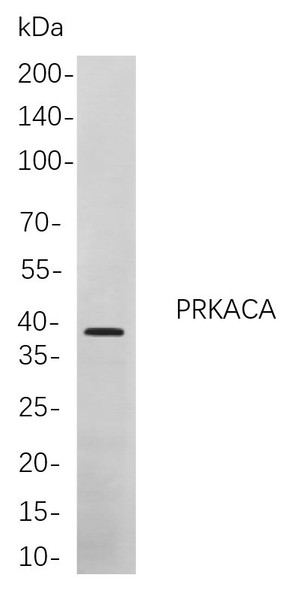Recombinant PRKACA Monoclonal Antibody (AGEL5865)