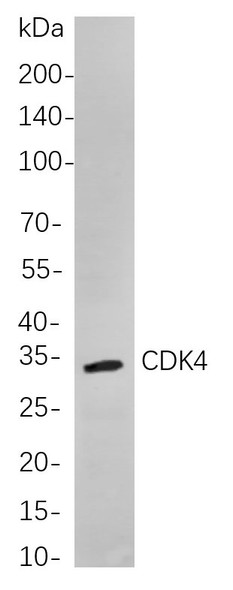 Recombinant CDK4 Monoclonal Antibody (AGEL5874)