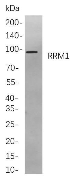 Recombinant RRM1 Monoclonal Antibody (AGEL5878)
