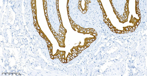 Recombinant Cytokeratin 7 Monoclonal Antibody (AGEL5886)