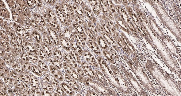 Recombinant IRF3 Monoclonal Antibody (AGEL5887)