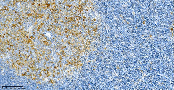 Recombinant HLA-DR Monoclonal Antibody (AGEL5888)