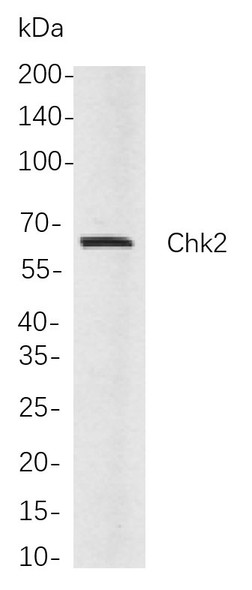 Recombinant Chk2 Monoclonal Antibody (AGEL5893)