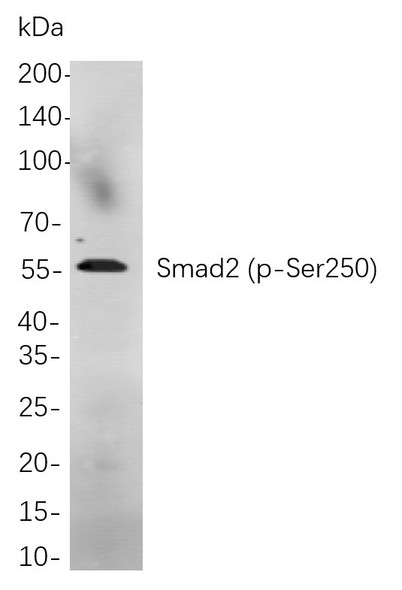Recombinant Phospho-Smad2 (Ser250) Monoclonal Antibody (AGEL5898)