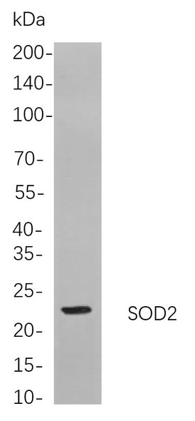 Recombinant SOD2 Monoclonal Antibody (AGEL5899)