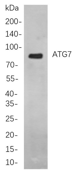 Recombinant ATG7 Monoclonal Antibody (AGEL5908)