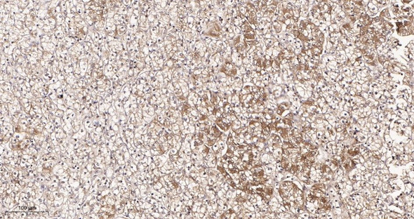 Recombinant N Cadherin Monoclonal Antibody (AGEL5919)
