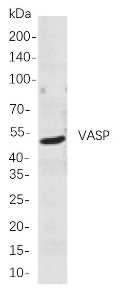 Recombinant VASP Monoclonal Antibody (AGEL5921)