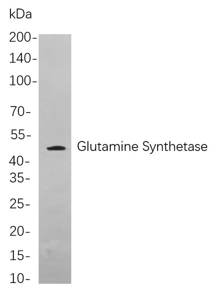 Recombinant Glutamine Synthetase Monoclonal Antibody (AGEL5922)