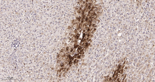 Recombinant Glutamine Synthetase Monoclonal Antibody (AGEL5922)