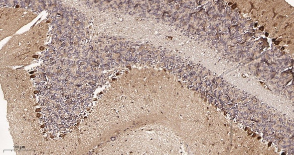 Recombinant S6K1 Monoclonal Antibody (AGEL5926)